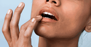 4-cold-sore-tips