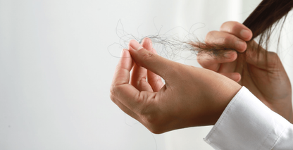Hair loss on Mounjaro or Wegovy