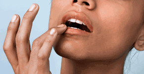 4-cold-sore-tips-v2