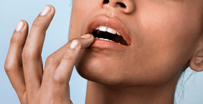 4-cold-sore-tips-v3