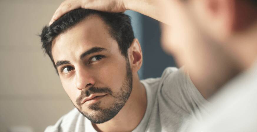man checking hairline in mirror